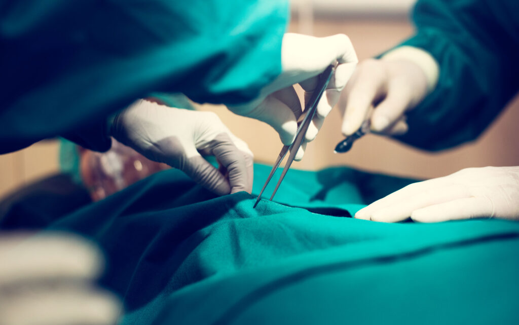 Cirugía Bariátrica en Aguascalientes